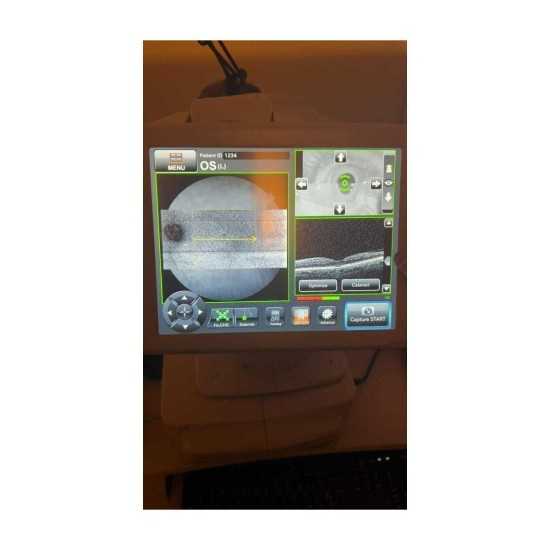 OCT Topcon Maestro 2 Jahr 2022 OCT Topcon Maestro 2 Jahr 2022