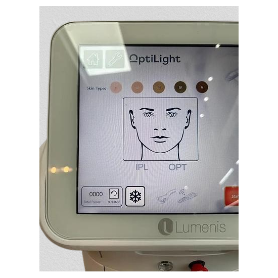 Optilight Dry Eye Lumenis