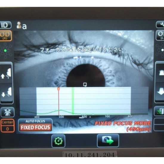 Endothelialmikroskop Topcon SP-1P