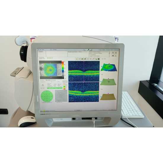 OCT Zeiss Cirrus 500 Jahr 2013