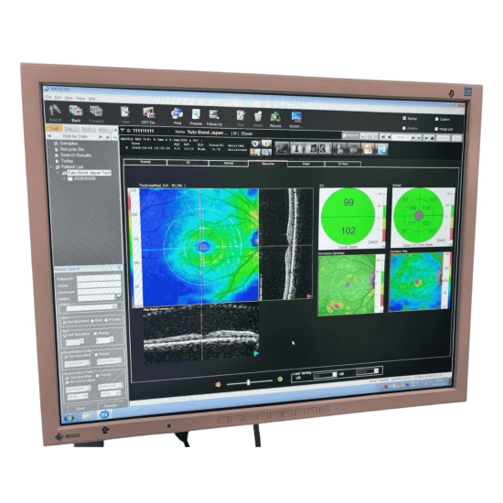 OCT Nidek RS-3000 Advance