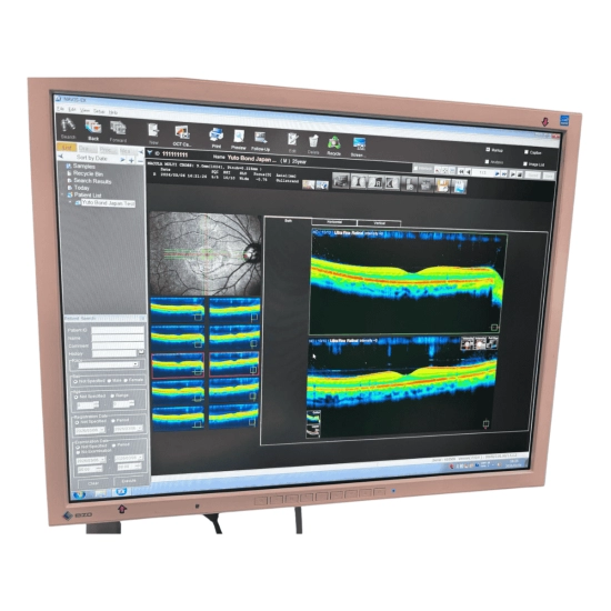 OCT Nidek RS-3000 Advance