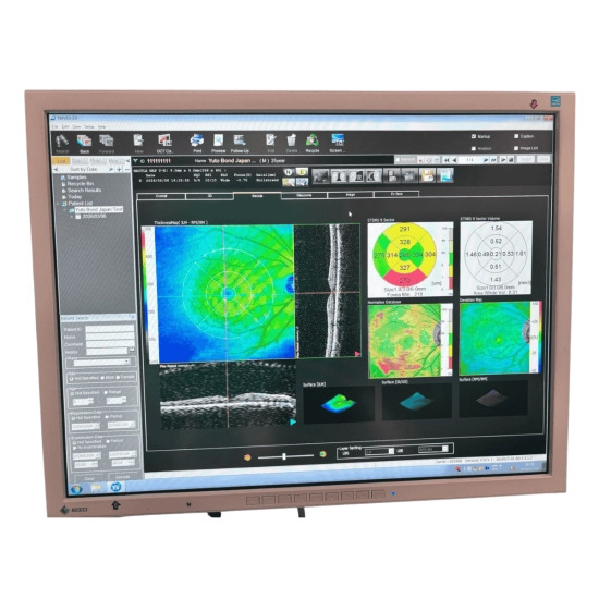 OCT Nidek RS-3000 Advance