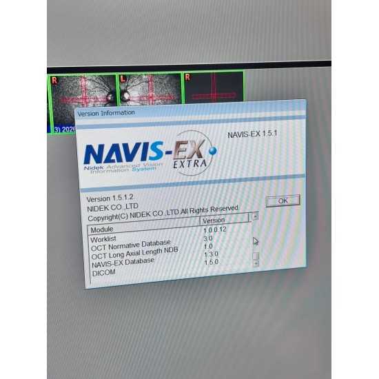 OCT Nidek RS-3000 Advance