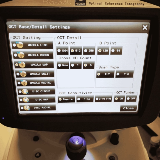 OCT Nidek RS-330 Duo